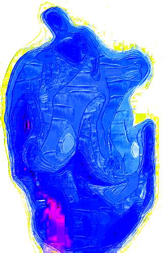 29